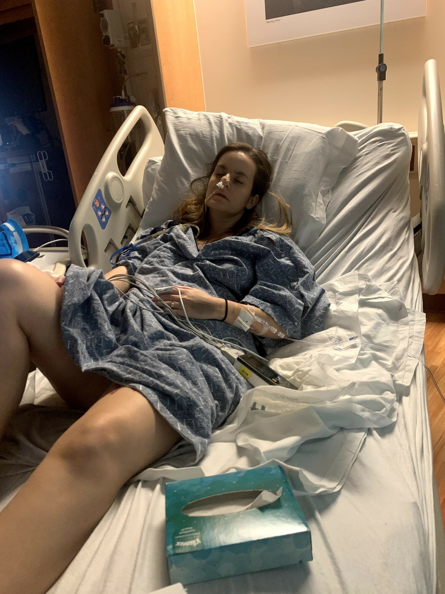 Woman lying in hospital bed with medical equipment, wearing a hospital gown, with a box of tissues nearby.