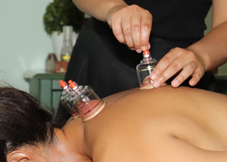 Person receiving cupping therapy on back with glass cups, practitioner applying suction, in a clinical setting.